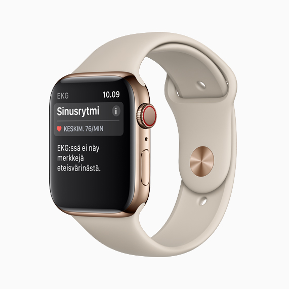 Apple Watch Series 4 showing sinus rhythm.