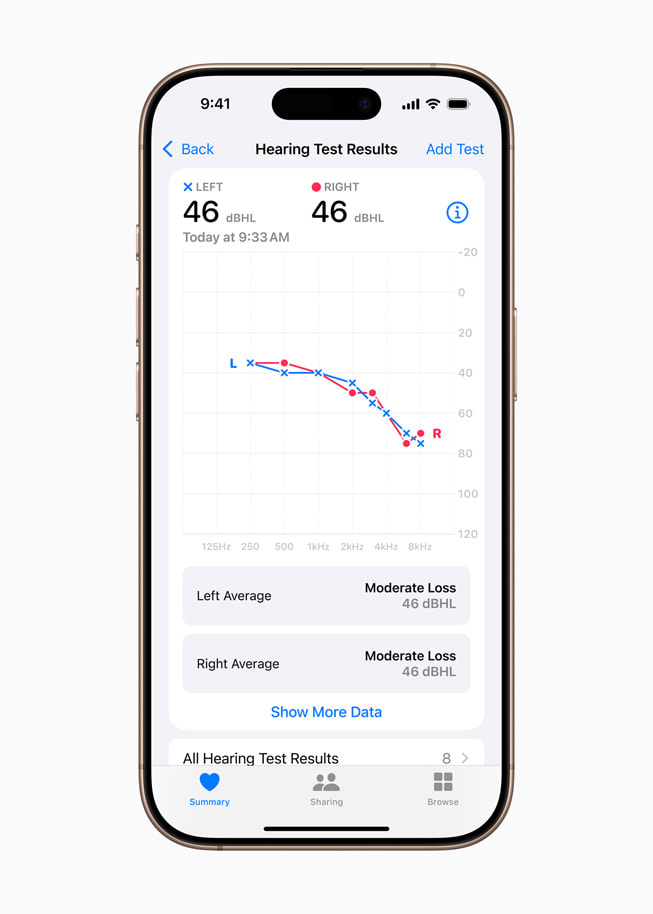 نتائج اختبار السمع معروضة في تطبيق صحتي على iPhone 16 Pro.