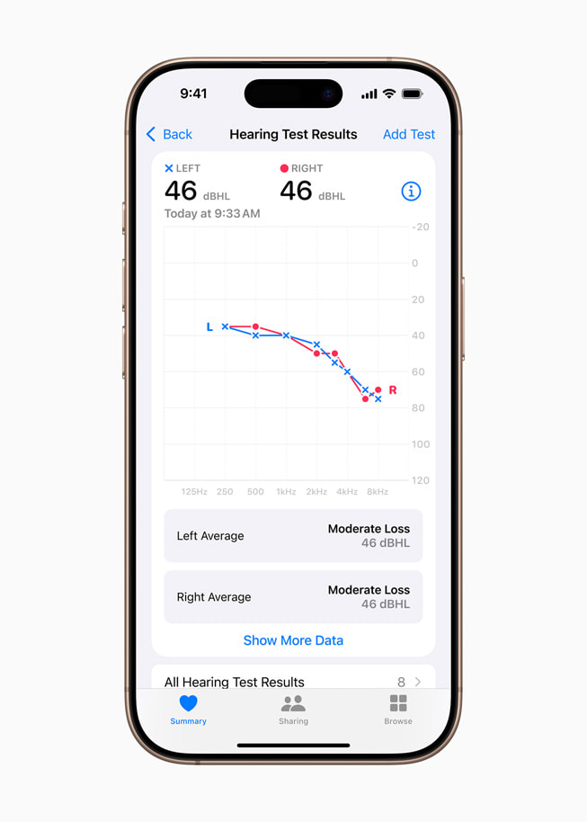 Biểu đồ kết quả từ Tính năng Kiểm Tra Thính Giác trên iPhone 16 Pro.
