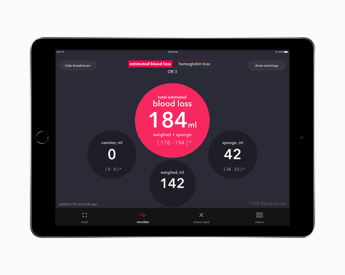 iPad demonstrating the blood loss tracking software used in Triton Sponge