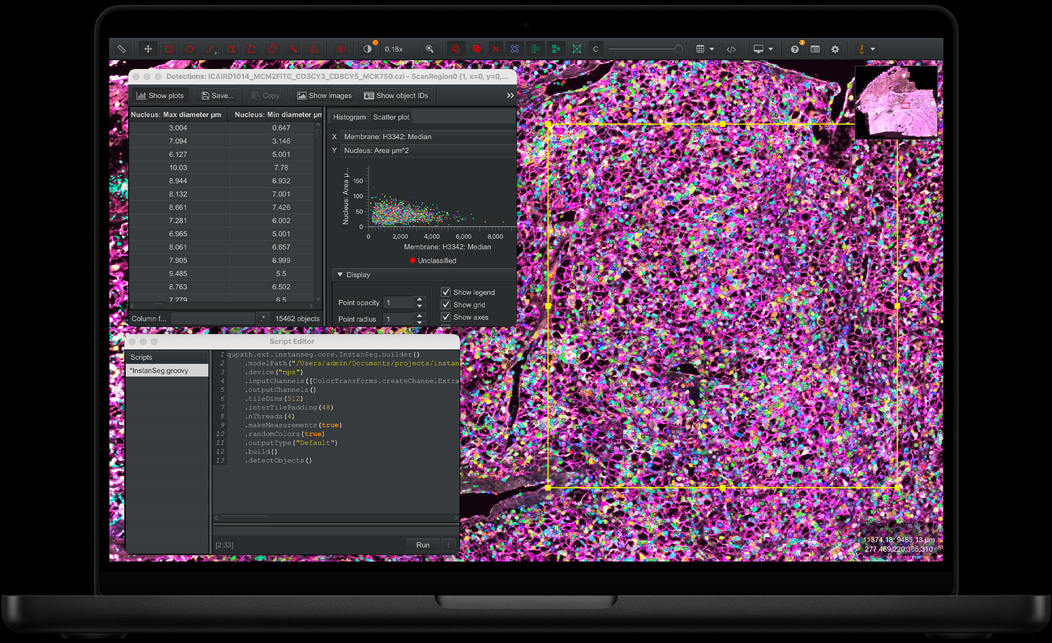 MacBook Pro 螢幕顯示 QuPath，展示粉紅色、紫色和綠色的熒光染色組織樣本；Script Editor 面板顯示程式碼，偵測表顯示細胞核直徑測量值，散點圖表